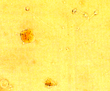 LeucoScreen - Cyto-chemical Stain For Detecting Granulocytes in Semen